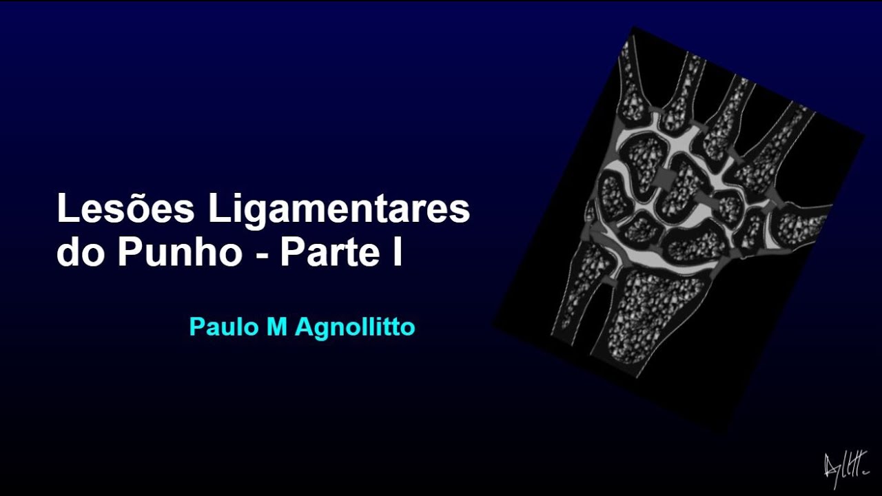 LESÕES LIGAMENTARES DO PUNHO (PARTE - 1)