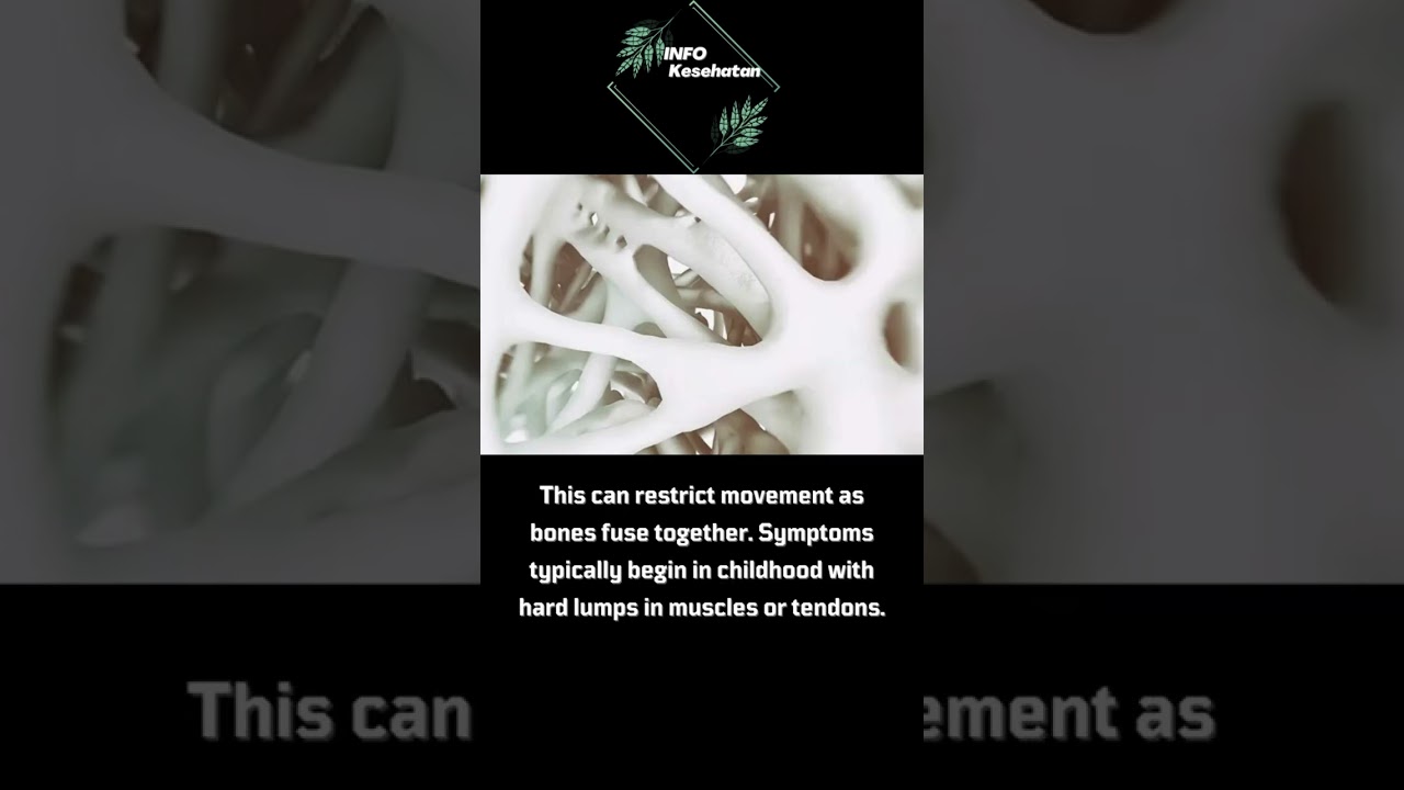 Rare genetic disorder causes body to form bone in soft tissues #shorts