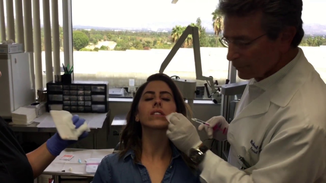 Volbella ~Michael A. Persky MD FACS - Top Facial Plastic Surgeon Los Angeles ~ Volbella