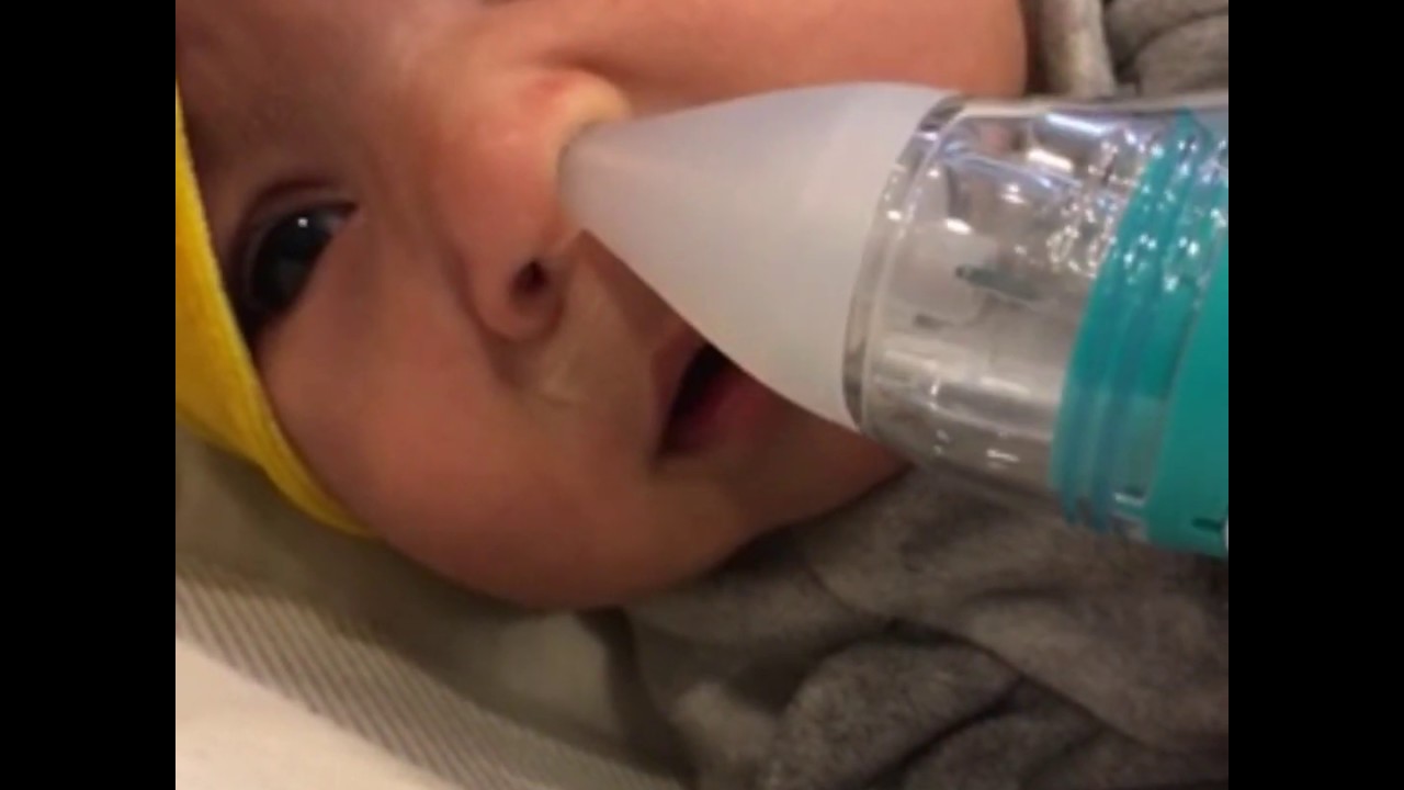 OCCOBaby Nasal Aspirator - Instant Relief For Babies