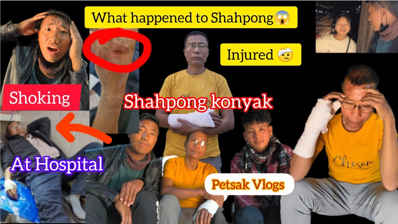 What happened to @shahpongkonyak4067 😱 Journey to Mon With @Petsakvlogs #nagaland #injury 