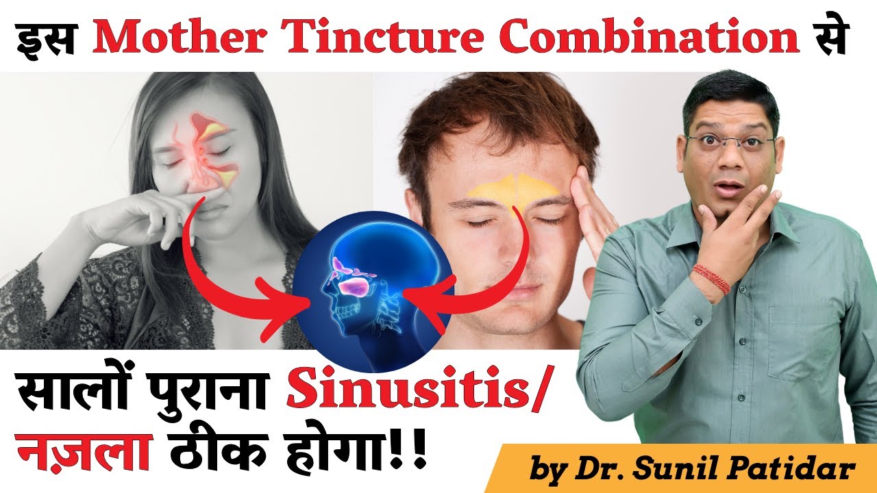 Best Mother Tincture Combination for Sinusitis | Sinusitis Homeopathy Treatment in Hindi #sinusitis