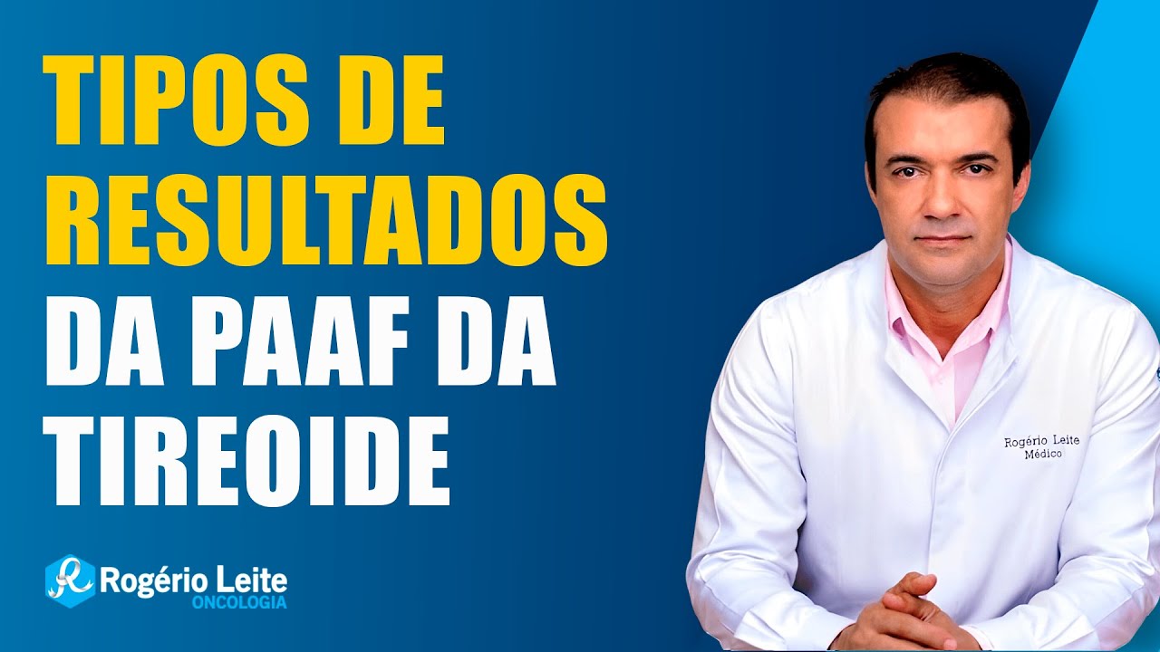 Tipos de Resultados da PAAF da Tireoide