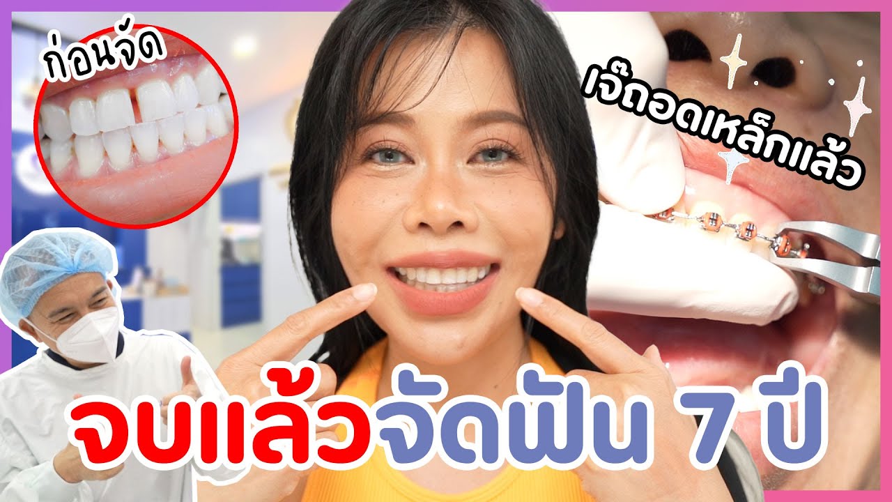 ถอดเหล็กแล้ว!! จัดฟัน 7 ปี จบปัญหา ฟันห่าง รากฟันอักสบ เคี้ยวข้าวไม่ได้  | BEAUTY MOUTHSY