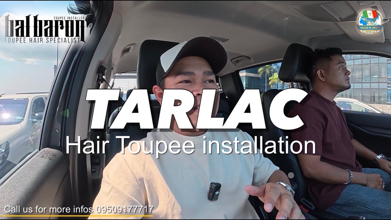 Toupee installation TARLAC|Bal Baron Toupee Hair Specialist