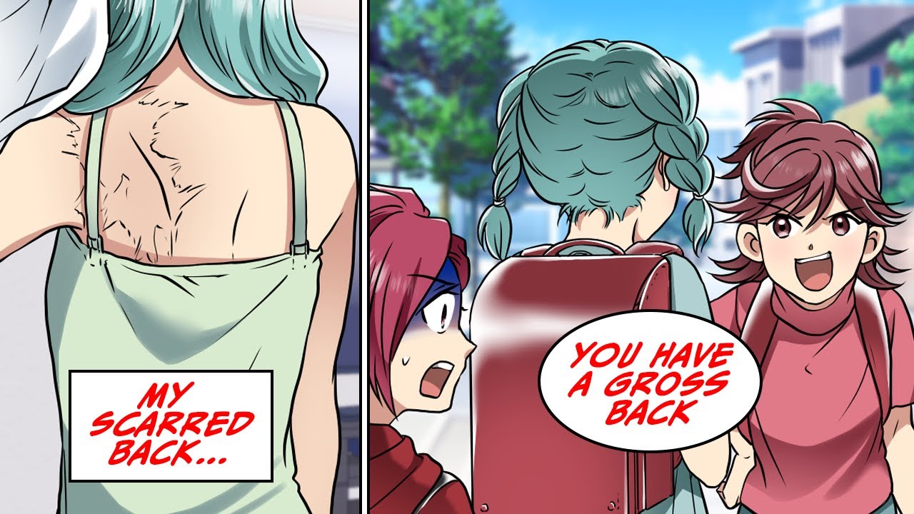 My older sister ended up getting scarred because of me... [Manga Dub]