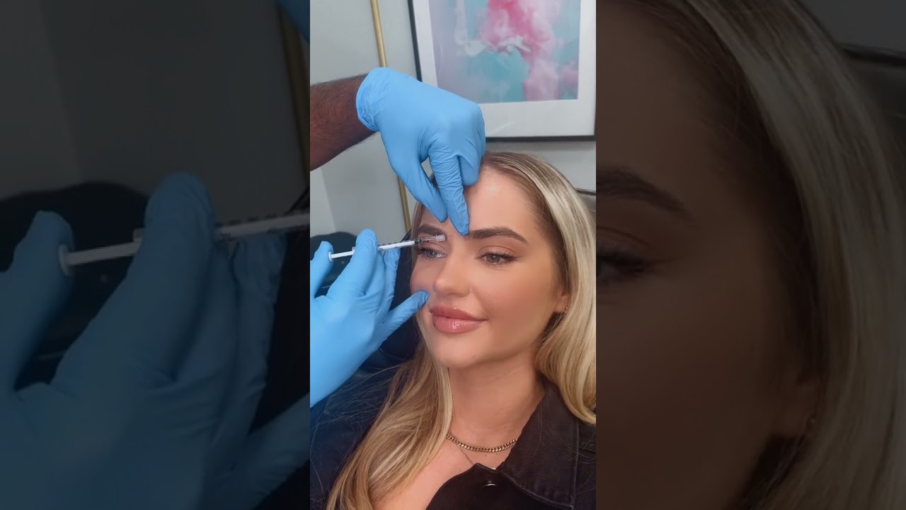Botox on our beautiful patient by Dr Tameem & Lorin NP