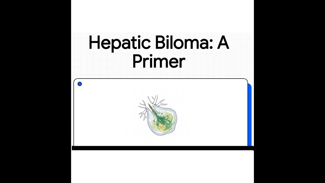 Hepatic Biloma | Pathophysiology, Diagnosis & Clinical Management