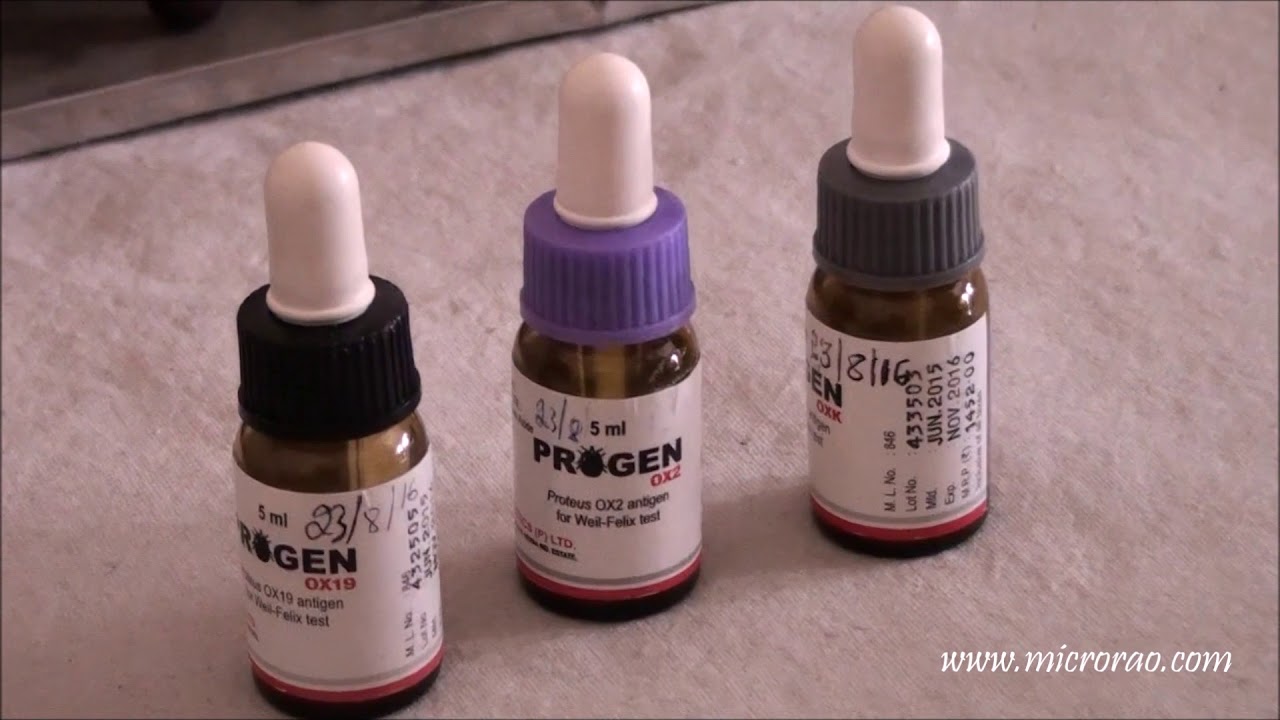 Weil Felix- a slide agglutination test for Rickettsial diseases