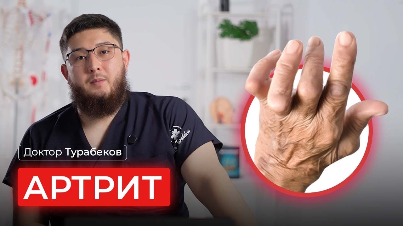 АРТРИТ | ДОКТОР ТУРАБЕКОВ | ОНЛАЙН КОНСУЛЬТАЦИЯ