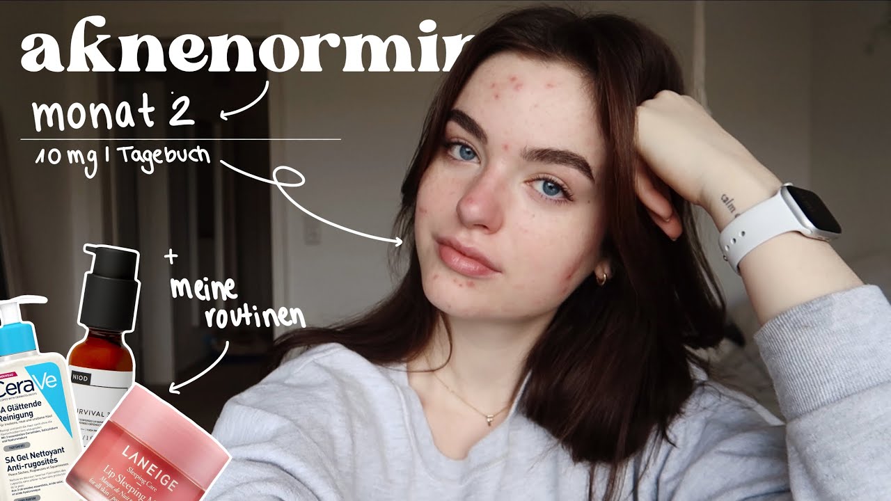 Aknenormin-Tagebuch | Monat 2 - 10mg (bei leichterer Akne) | Fabienne Bethmann