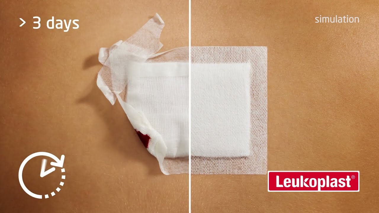 Leukoplast® Hypafix® Wide Area Fixation