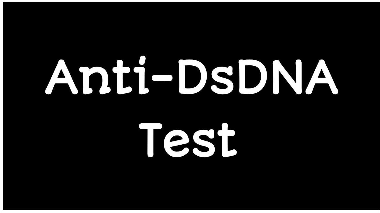 What is the Anti-DsDNA test and how does it work?