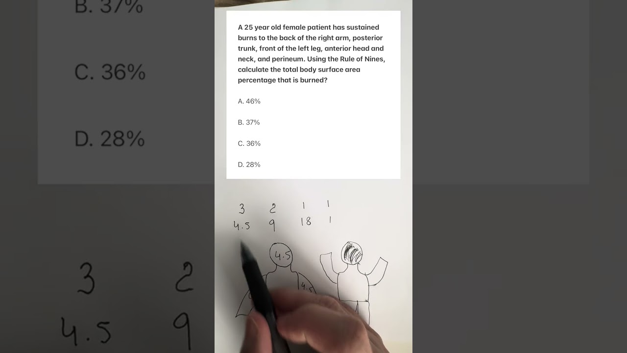 Rule of 9 burn patient trick to learn with practice question Nclex