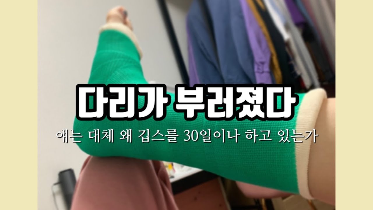 [갬수성일상] 오른발🦶🏼 파업함 / 30일의 깁스생활