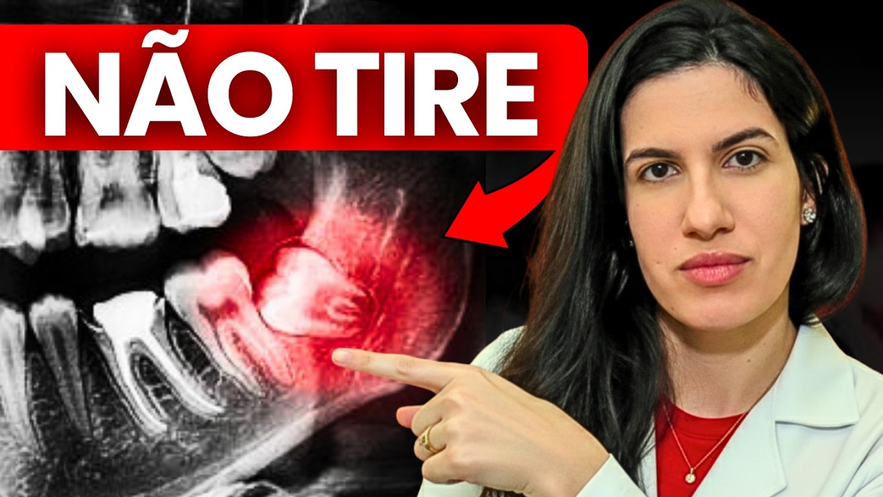 TUDO o que você precisa saber antes de ARRANCAR O SISO (dentista explica)