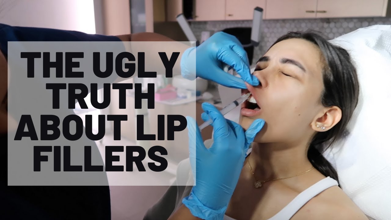WHAT DID I DO TO MY LIPS
