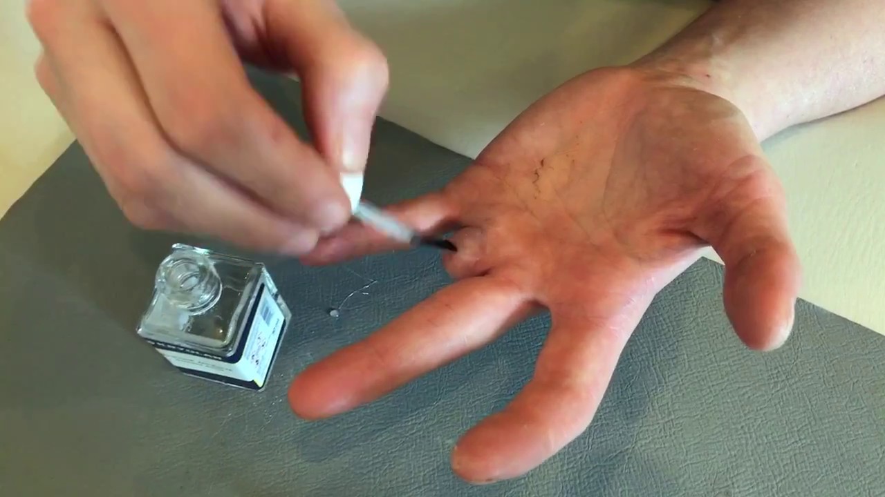 Fingerprothese und Hautkleber
