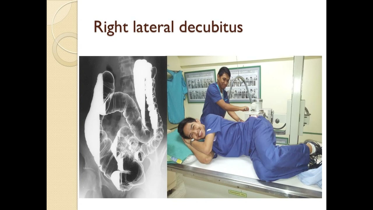 Barium Enema, procedure and patterns