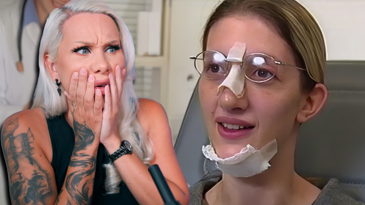 Lost TV show FOUND! The WEIRDEST episode of Extreme Makeover: Plastic Surgery