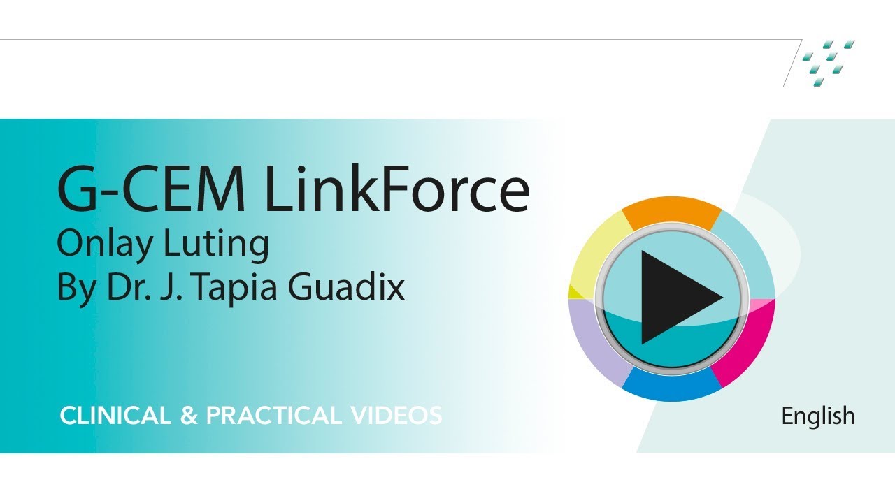 Onlay luting with G CEM LinkForce dual cure resin cement by Dr. J. Tapia Guadix