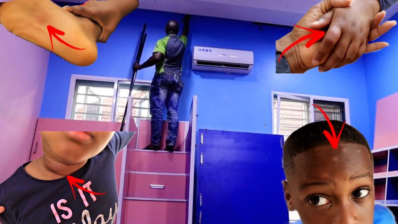 Unusual INSECT BITE on my kids | Thorough FUMMIGATION & CLEANING of their room