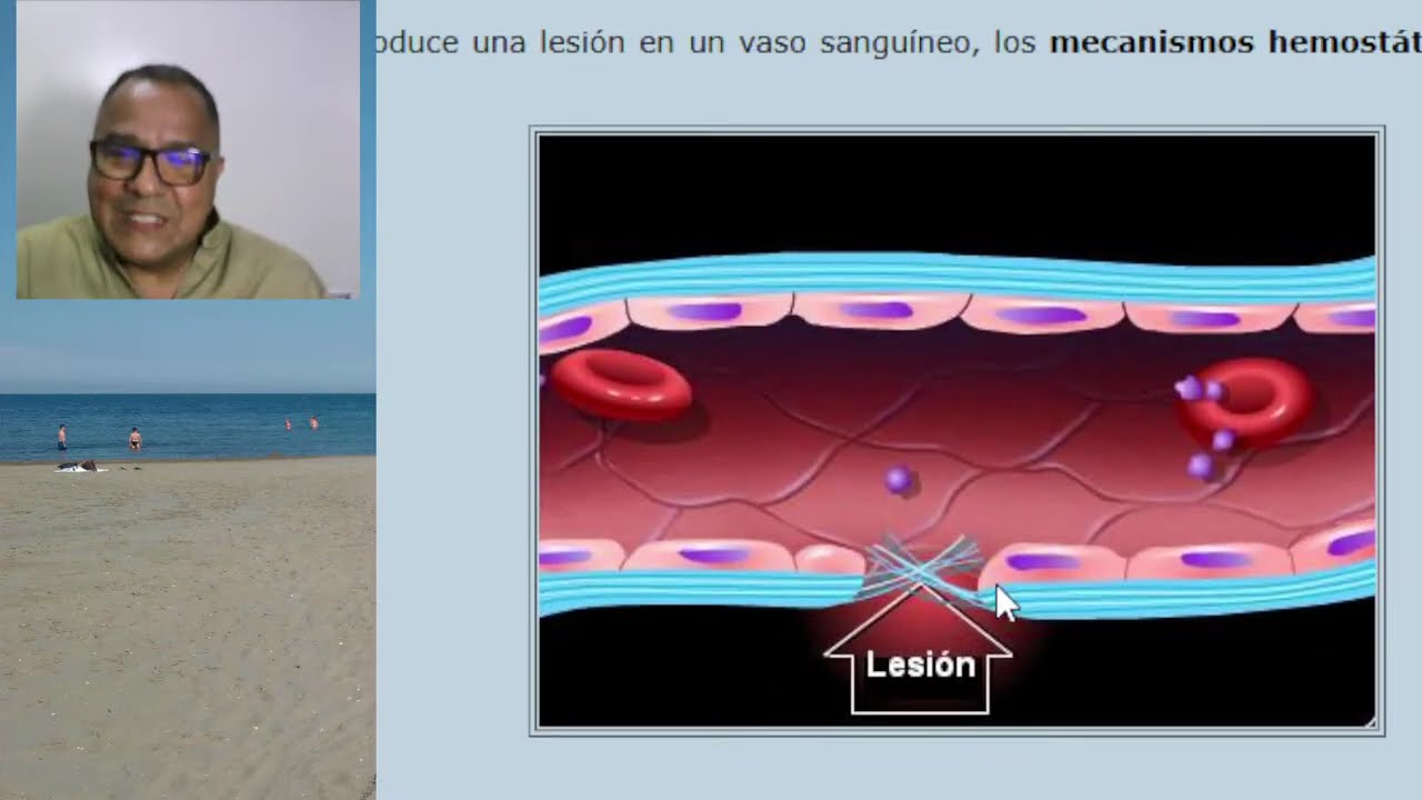 HEMOSTASIA: Vasoconstricción, agregación plaquetaria y anticoagulación