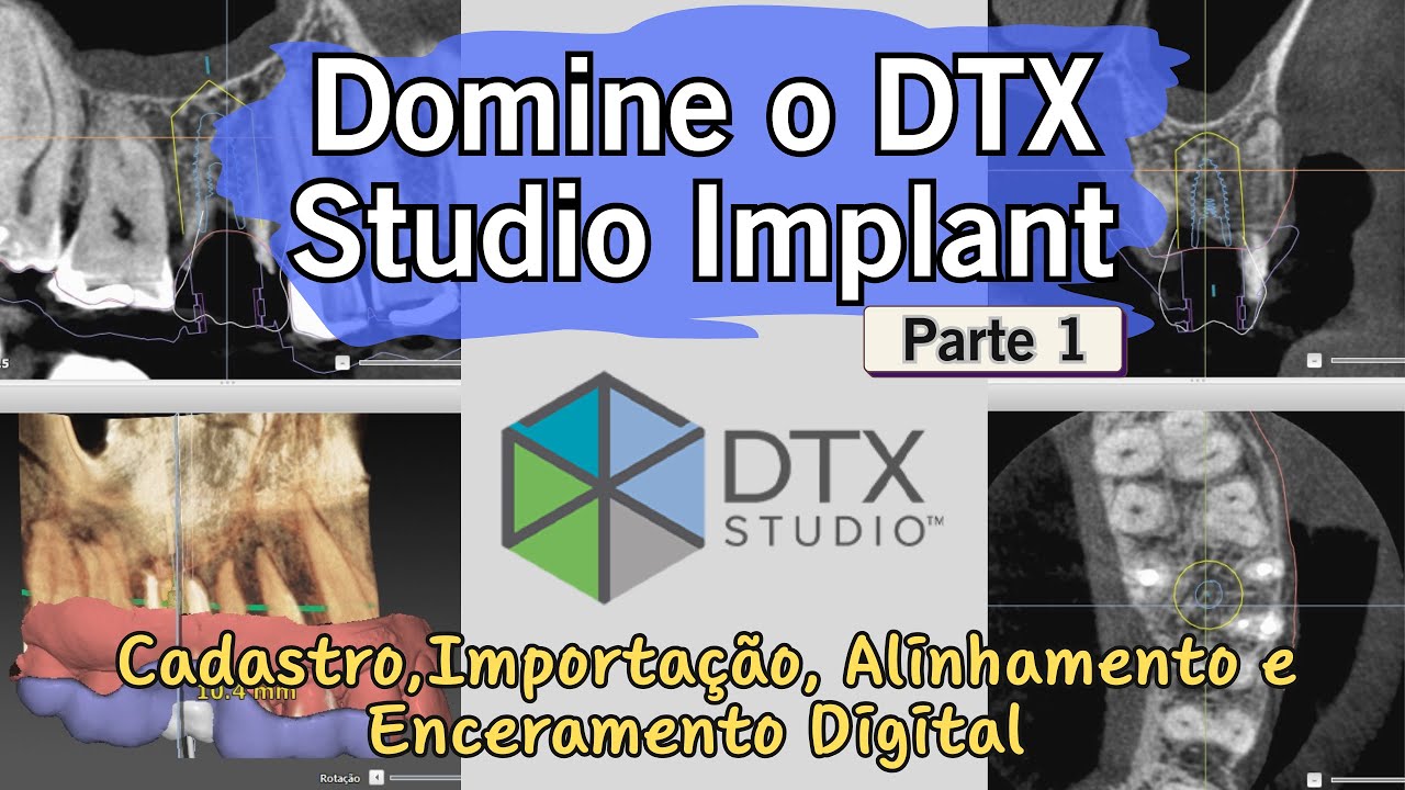 Passo a passo no DTX Studio Implant : Organização dos dados e início do planejamento do caso.