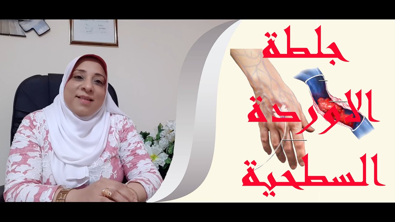 جلطة الاوردة السطحية مع د. هيام
