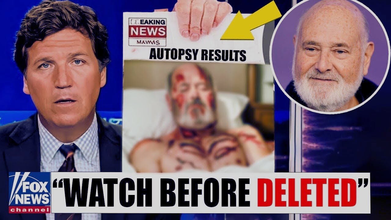 FBI releases Rob Reiner's autopsy results and key findings