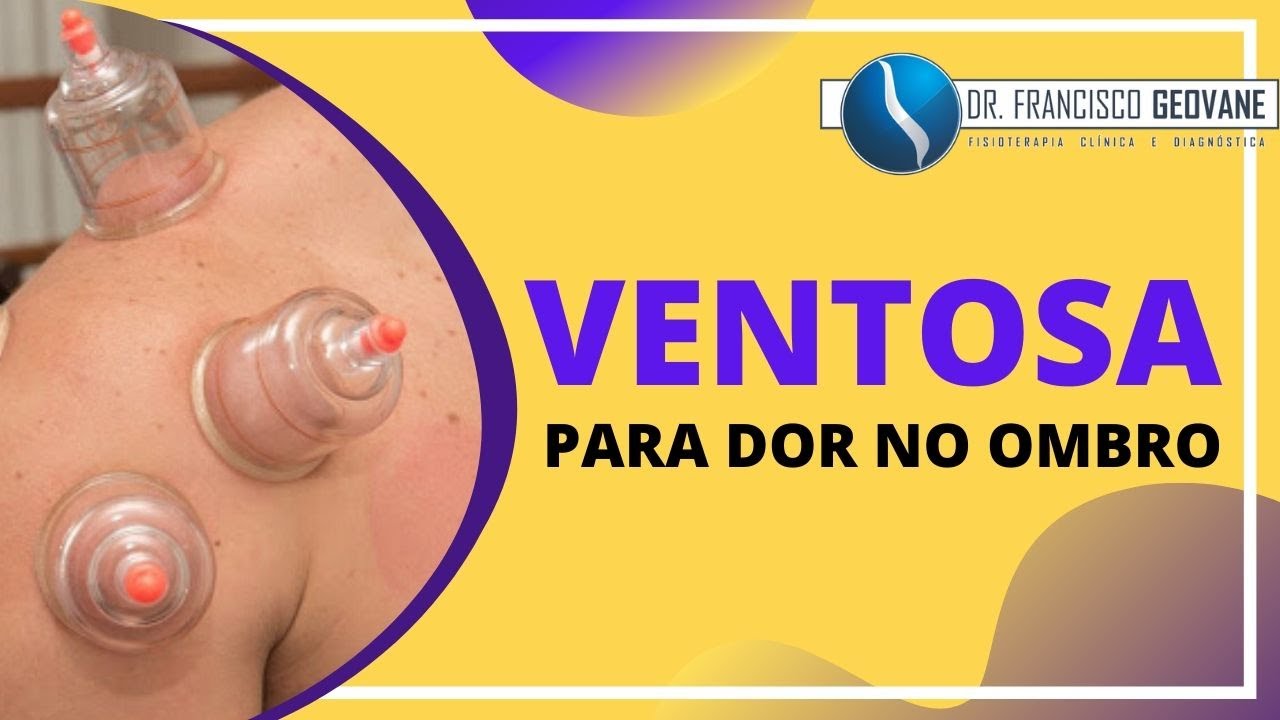 VENTOSATERAPIA PARA DOR NO OMBRO -  Como as ventosas podem ajudar quem sofre com dor no ombro