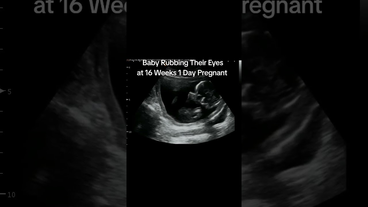 Baby rubbing the eyes on ultrasound at 16 weeks, 1 day pregnant.  #heybabymobile #babyrubbingeyes