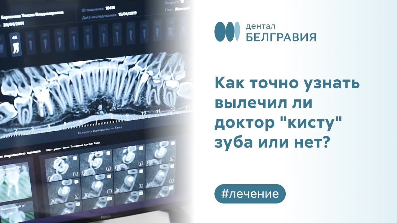🦷 Как точно узнать вылечил ли доктор 