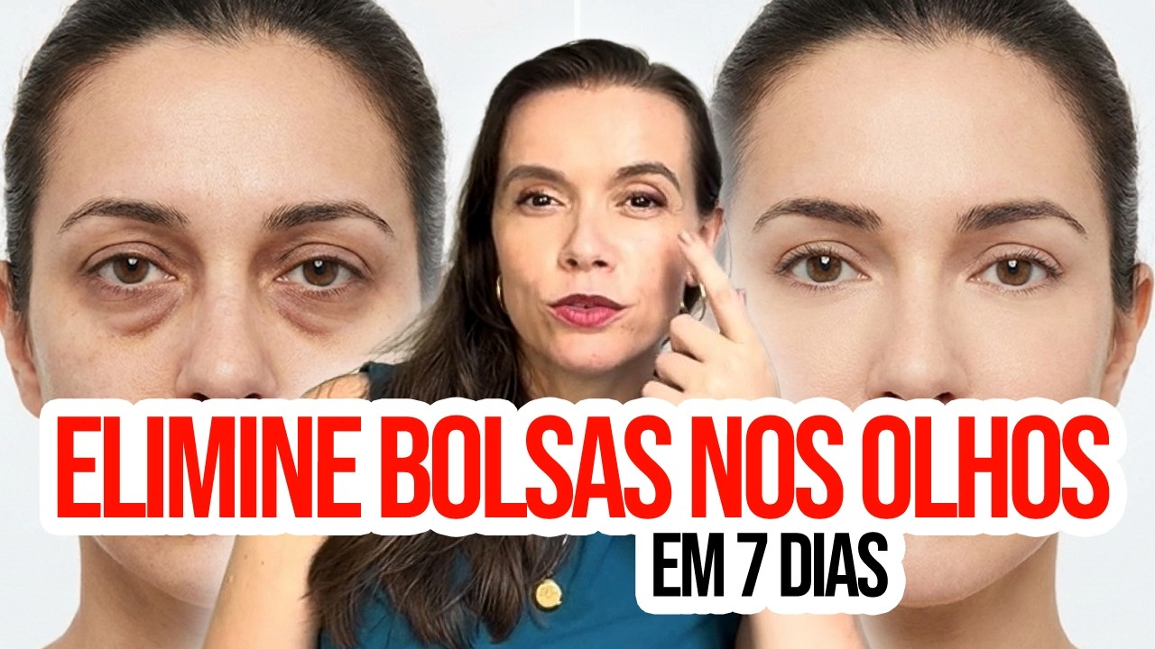 REVELADO: Como tirar BOLSAS NOS OLHOS em CASA! VEJA AQUI