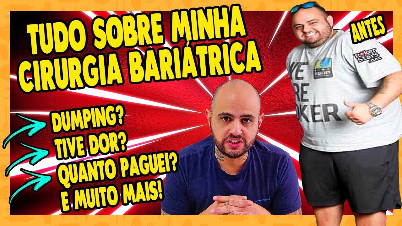 ABSOLUTAMENTE TUDO SOBRE MINHA CIRURGIA BARIÁTRICA | Mais de 50 fatos!