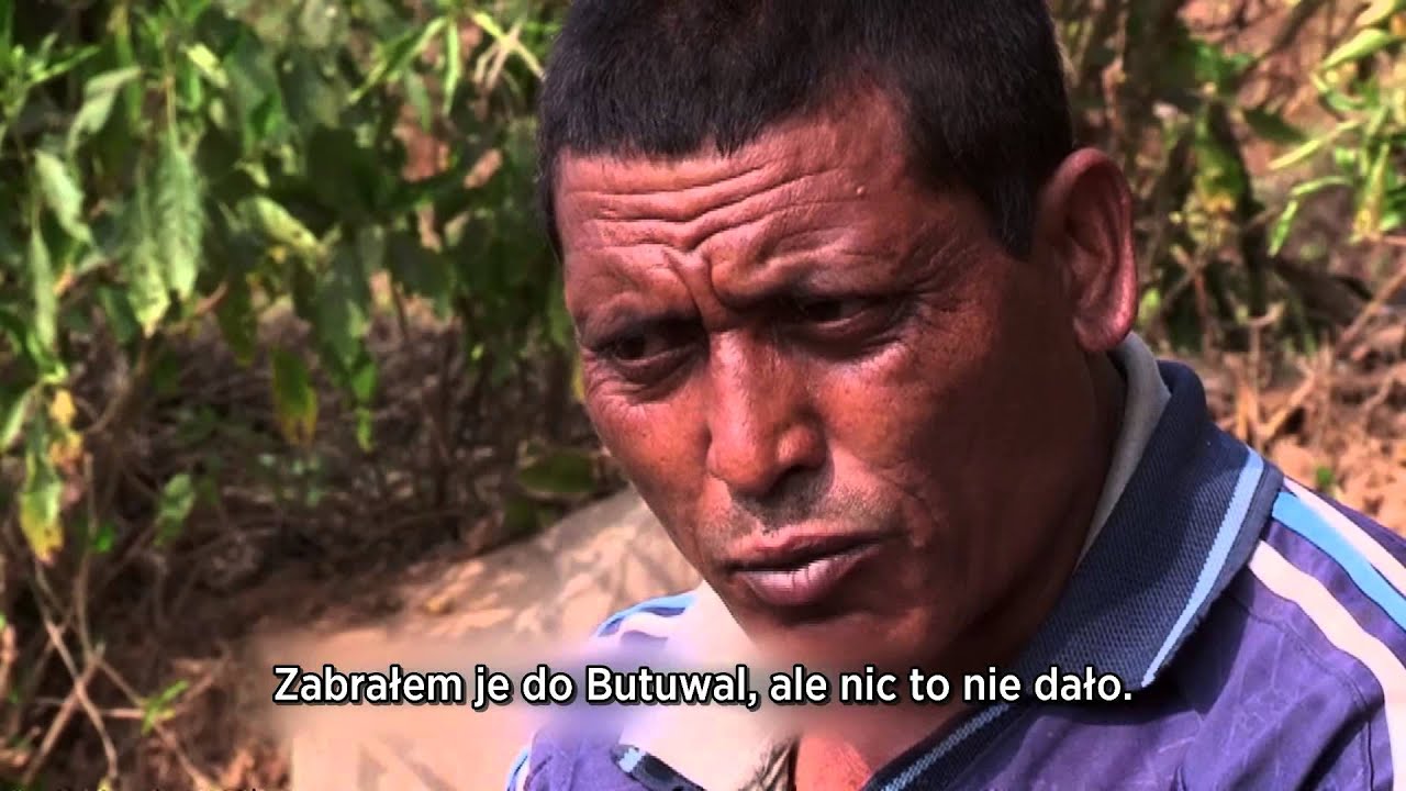 Discovery Channel - Nie do uwierzenia - Szklane kości