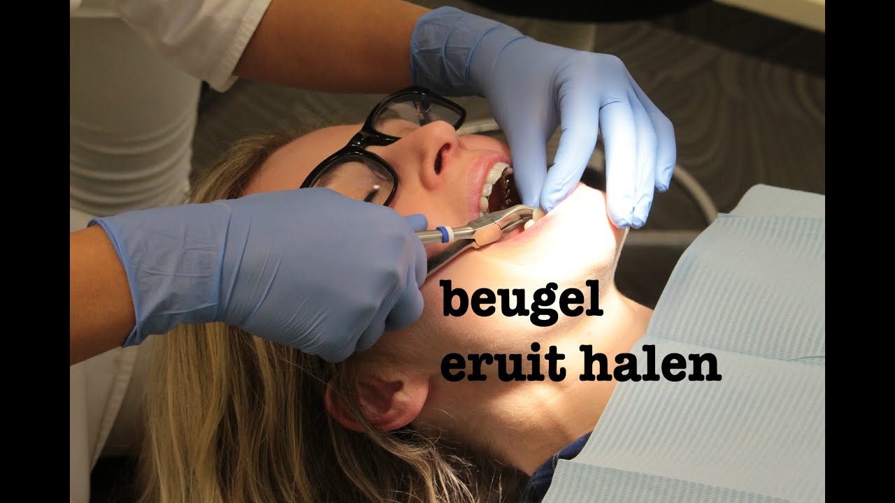 Beugel eruit halen | FURROW.NL