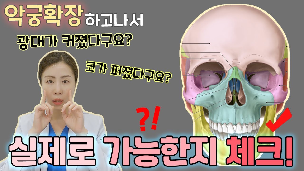 치아교정을 위한 악궁확장, 악궁확장장치로 얼굴변화를 가져올 수 있을까요? 해부학적 구조와 함께 체크해보아요^^
