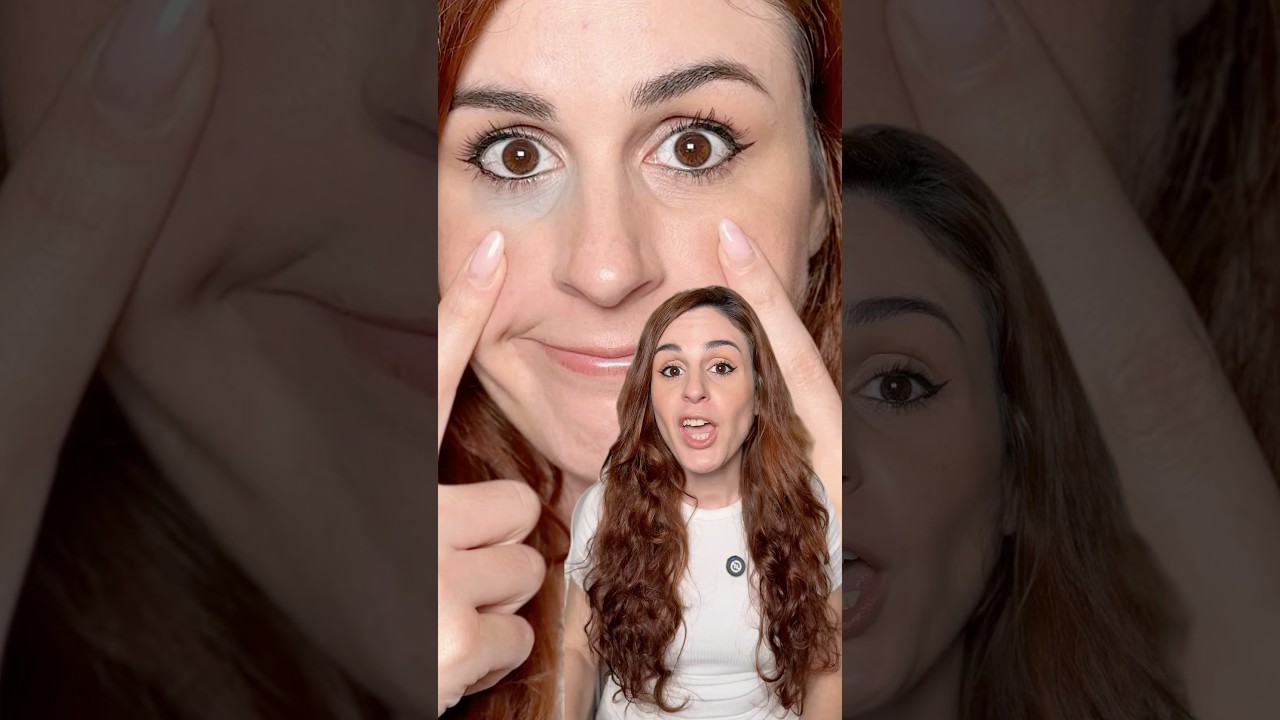 ¿Cómo corregir ojeras oscuras y que no se vean grises? 