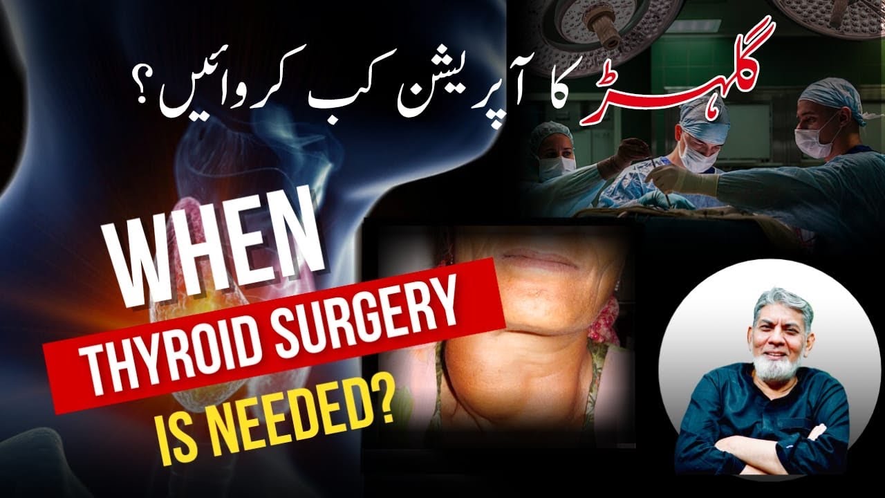 Disease of thyroid Gland: When we need surgery? | Prof De Javed Iqbal |