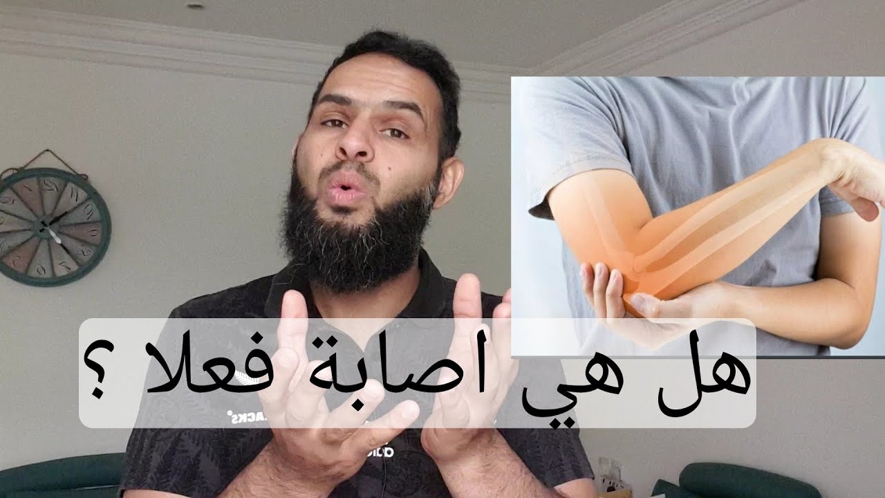 آلام الاجهاد المصاحب لممارسة الرياضة