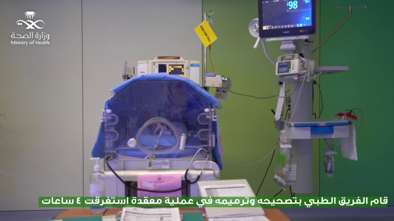 قصة عملية #1