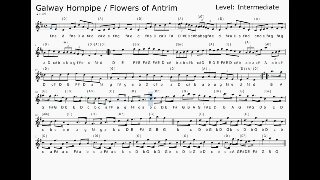 Galway Hornpipe / Flowers of Antrim Set (Amended score, tune the same)