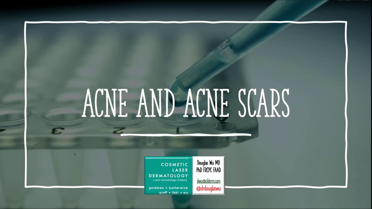 Eliminate Acne and Acne Scarring Once and For All | Cosmetic Laser Dermatology Webinar