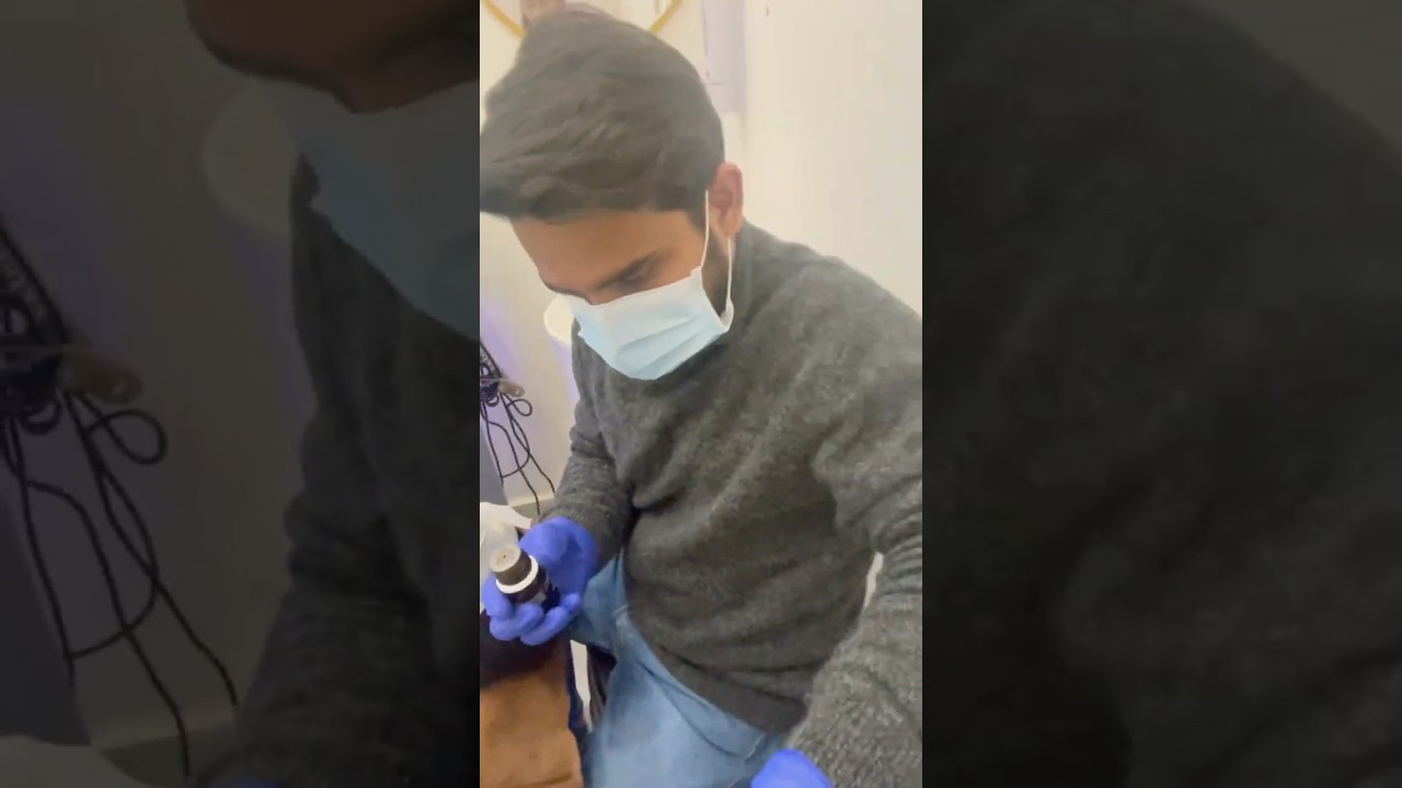 GK Peel Treatment | Dark Skin ke liye Best Chemical Peel