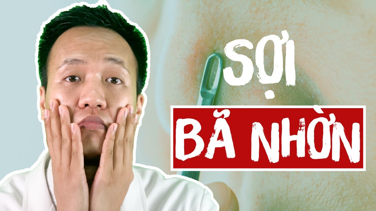 CHUYÊN GIA Tiết lộ 6 ĐIỀU quan trọng về SỢI BÃ NHỜN - TIPS Cách Trị mụn tại nhà | Dr Hiếu
