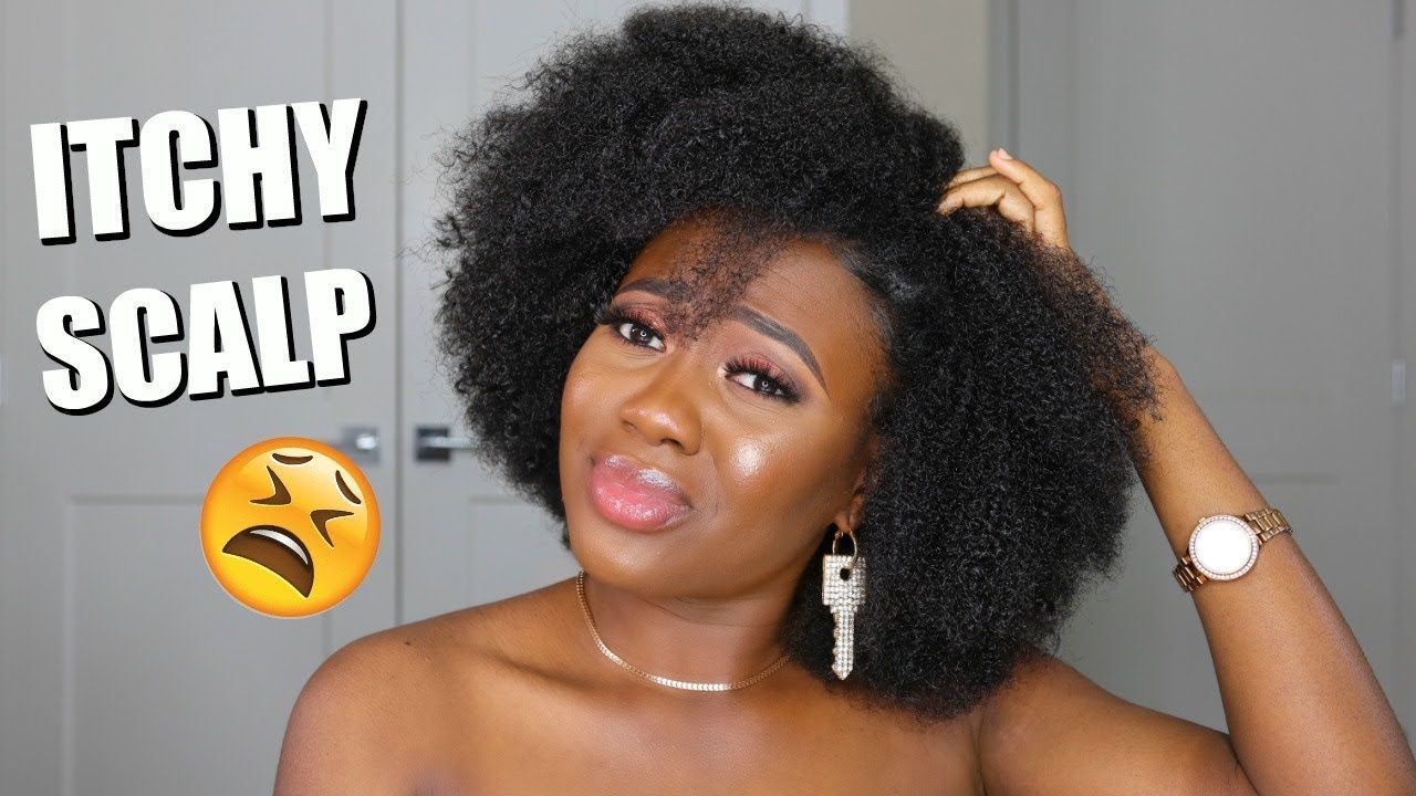 Natural Hair ITCHY SCALP DANDRUFF FLAKY & DRY SCALP | How To Get Rid Of Them | My Experience!