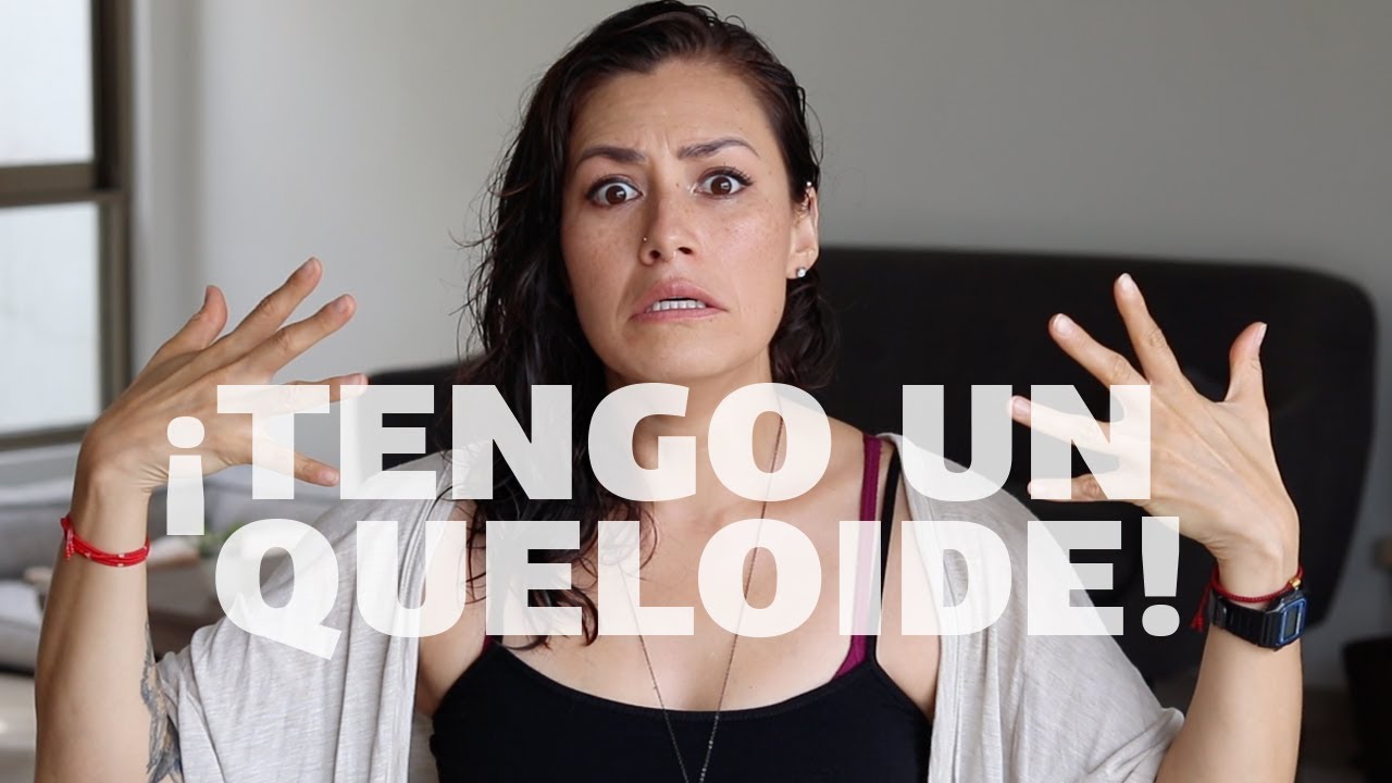 ¡¿Tengo un queloide!? 😱 | Piercings