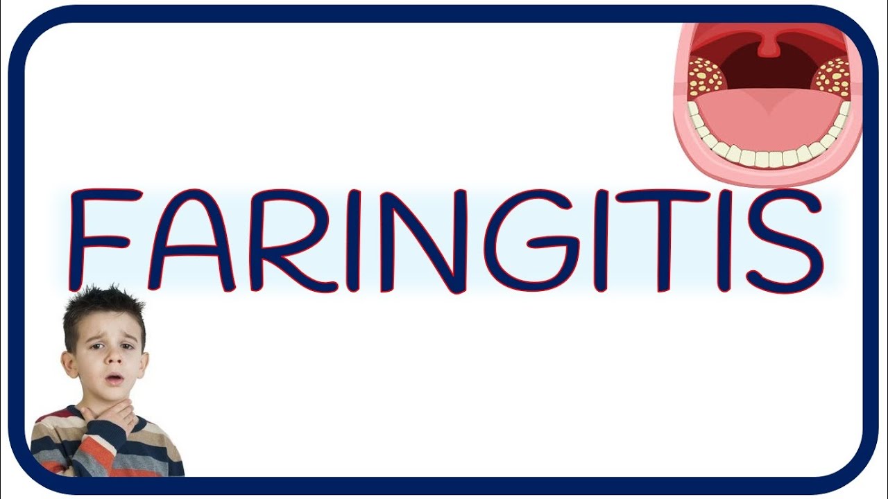 FARINGITIS - estreptocócica, viral, escarlatina, dolor y exudado faríngeo, fiebre y tratamiento