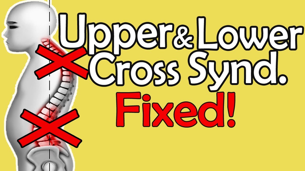 Lower Cross Syndrome & Upper Cross Syndrome Correction Exercises || Anterior Pelvic Tilt (APT) FIX!